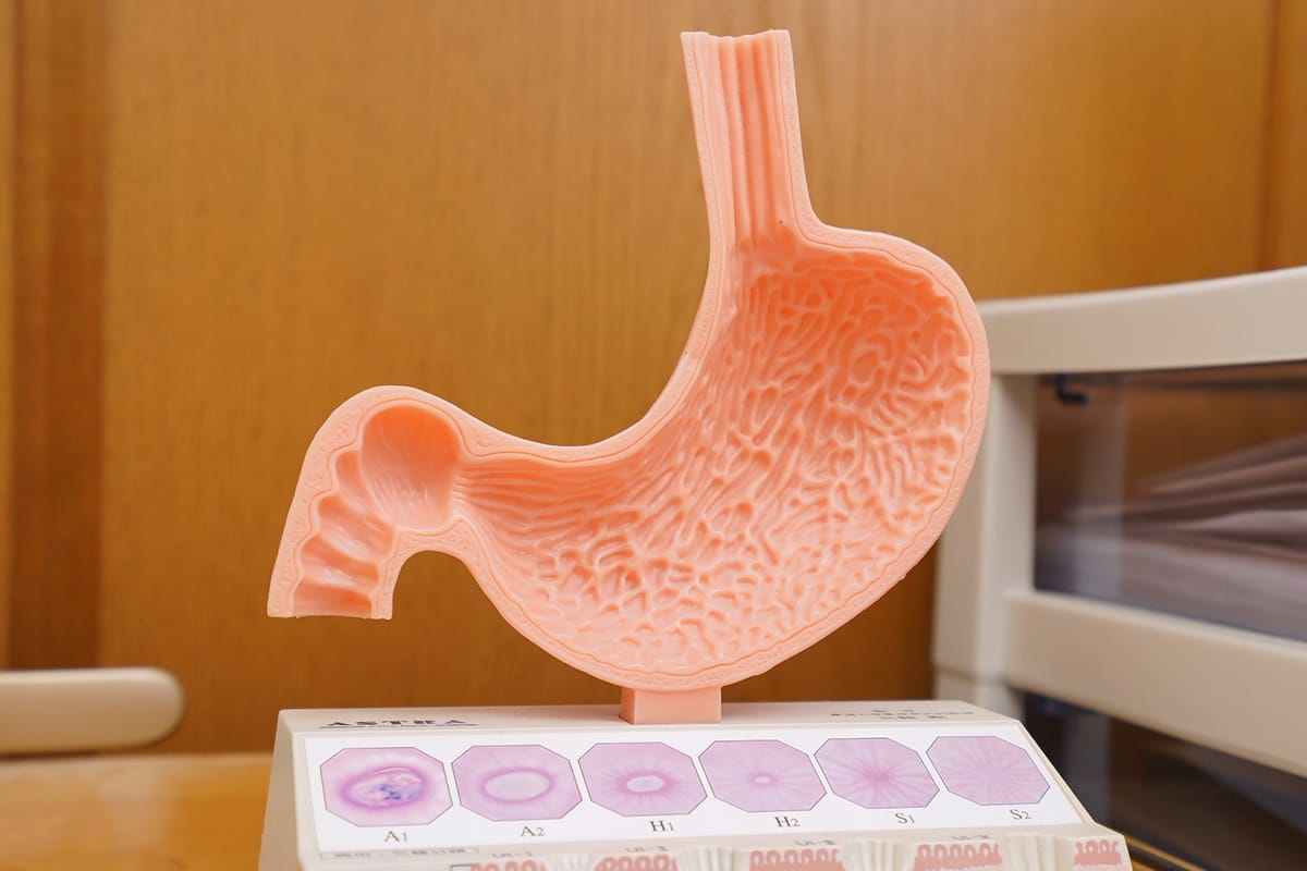 胃の模型